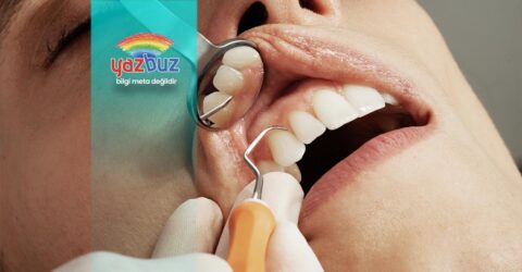 Evde Diş Taşları Nasıl Temizlenir?