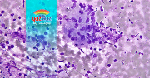 Sitoloji Nedir? Sitoloji Testi Nedir?