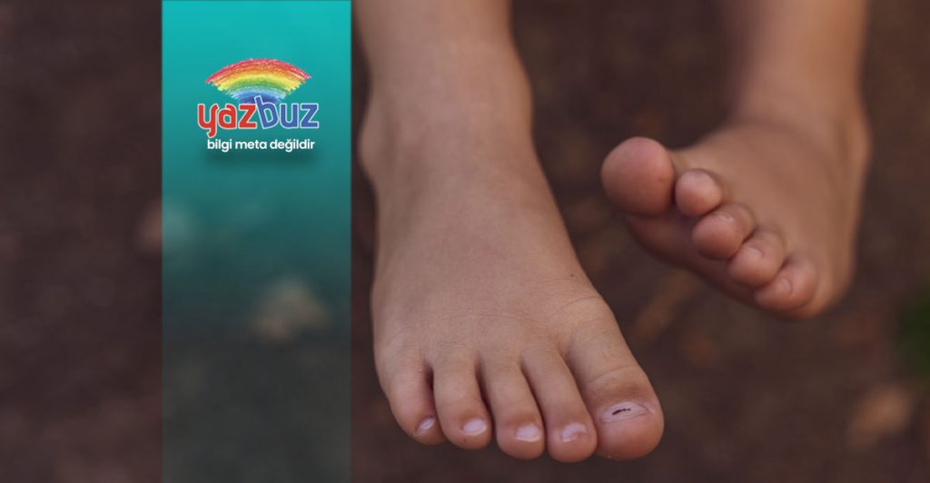 Ayak parmak morarmasına ne iyi gelir