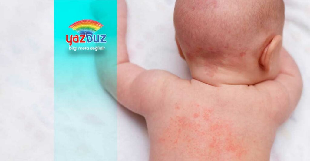 Bebeklerde Vücutta Kırmızı Lekeler Neden Olur? Tehlikeli mi?
