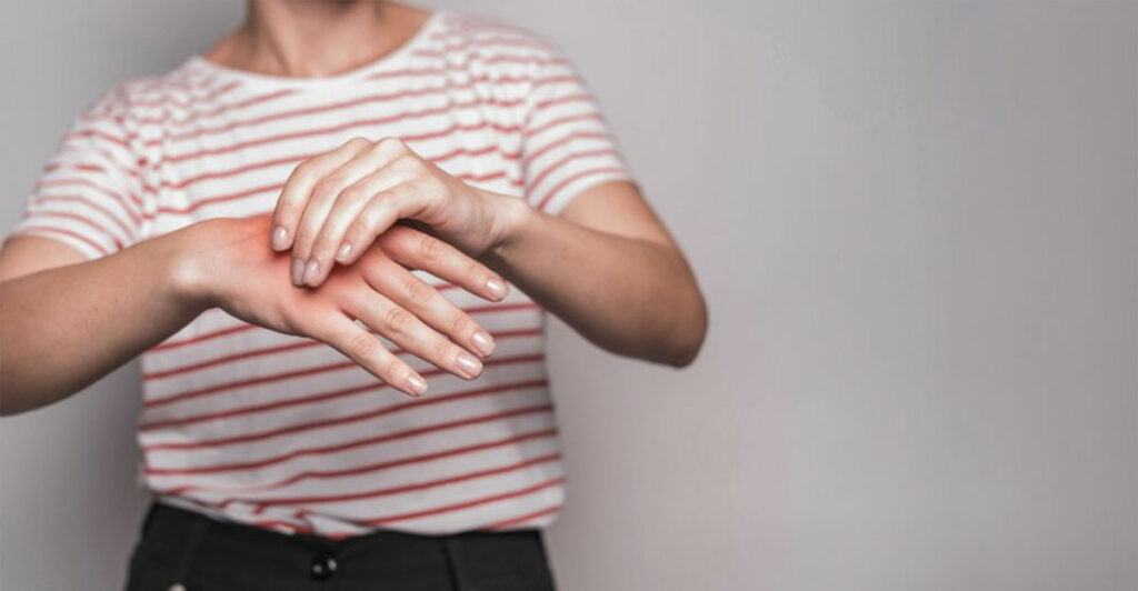 Tırnak morarması nasıl iyileşir